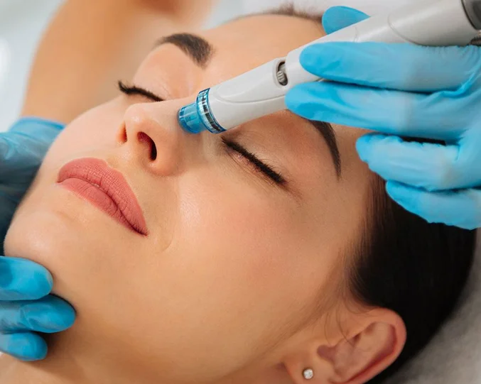 Bela MD Hydra Facial Service at Alpha Med Spa Clinic Brampton for deep cleansing and skin hydration