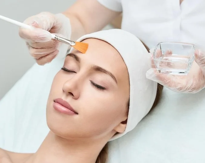 Chemical Peels Service at Alpha Med Spa Clinic Brampton for skin exfoliation and complexion renewal