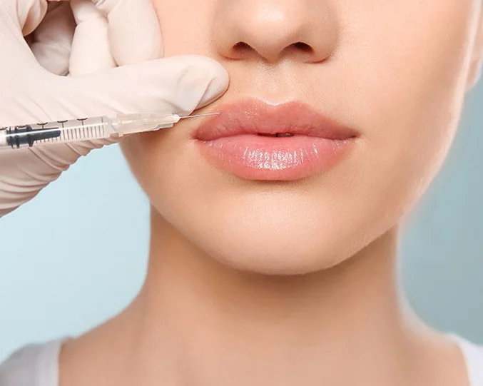 Dermal Fillers Service at Alpha Med Spa Clinic Brampton for natural lip enhancement and volume restoration