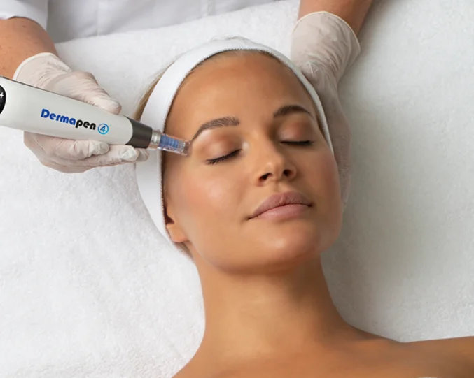 Dermapen Microneedling Service at Alpha Med Spa Clinic Brampton for skin rejuvenation and collagen stimulation