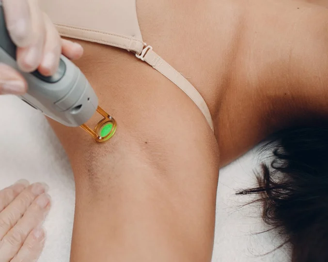 Underarm Laser Hair Removal Service at Alpha Med Spa Clinic Brampton using advanced laser technology for smooth skin
