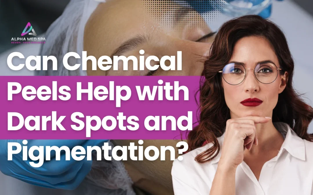 Can Chemical Peels Help with Dark Spots and Pigmentation?