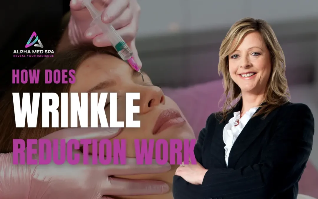 How Does Wrinkle Reduction Work by Alpha Med Spa Brampton, showing an educational anti-aging treatment graphic with a client receiving a professional wrinkle reduction procedure.